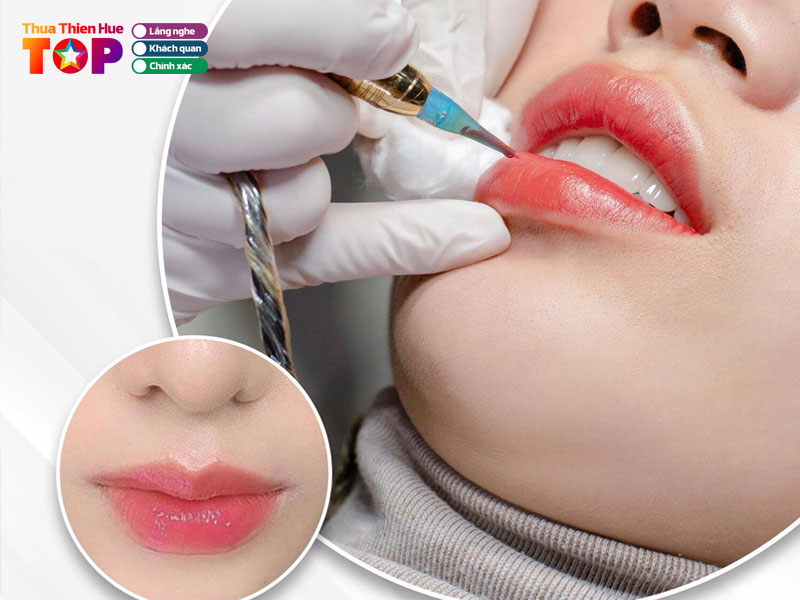 benh-vien-tham-my-truong-kieu-xuan-huetoplist