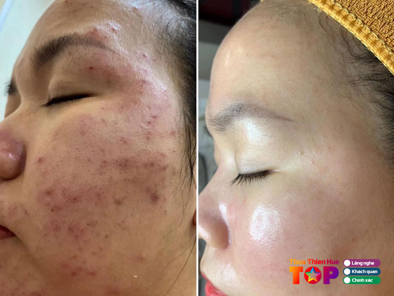 mylan-beauti-center-hue-huetoplist