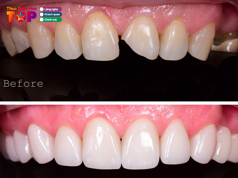 nha-khoa-cheese-huetoplist