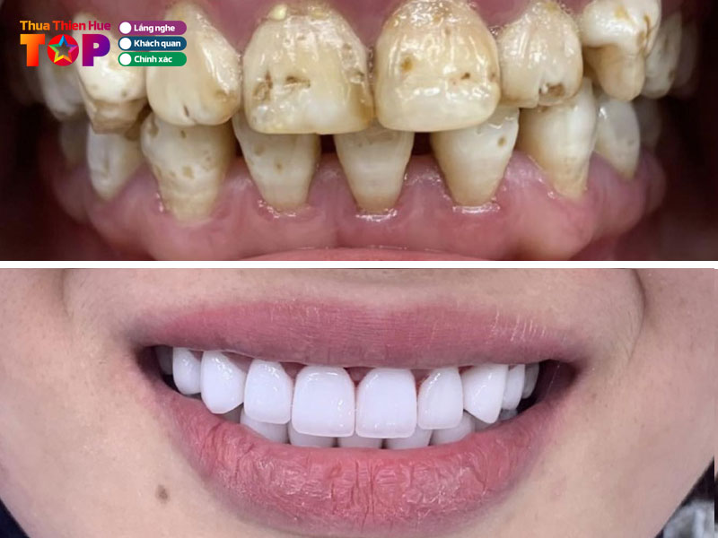 nha-khoa-co-do-huetoplist