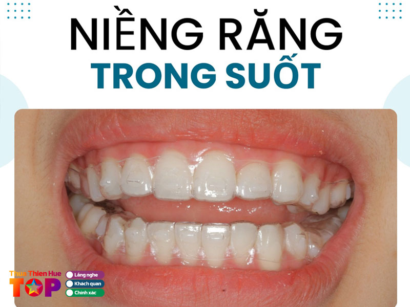 nha-khoa-t-care-huetoplist