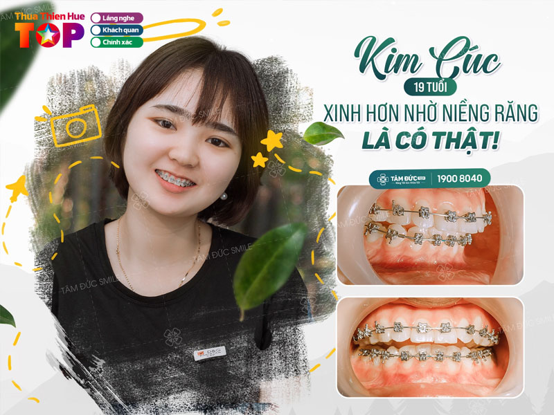 nha-khoa-tam-duc-huetoplist