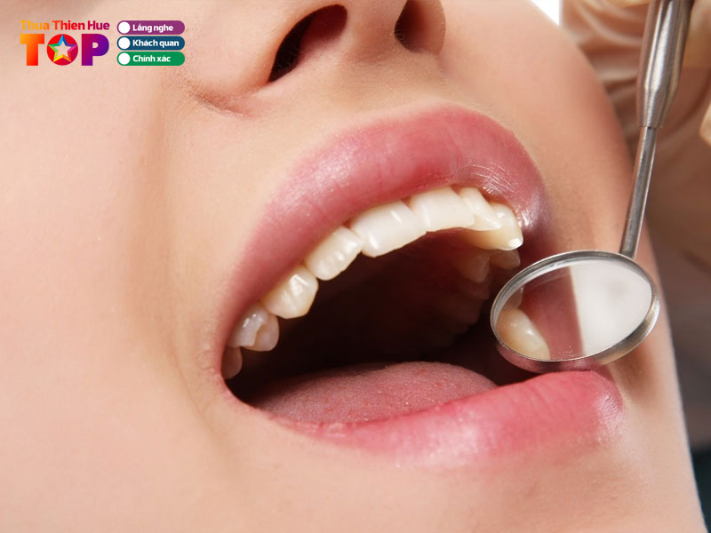 nha-khoa-thanh-tin-huetoplist