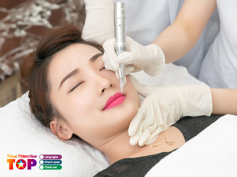 phun-theu-tham-my-cuc-hoang-huetoplist