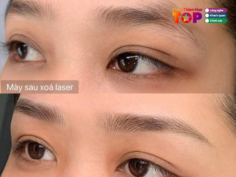 phun-theu-tham-my-cuc-hoang-huetoplist