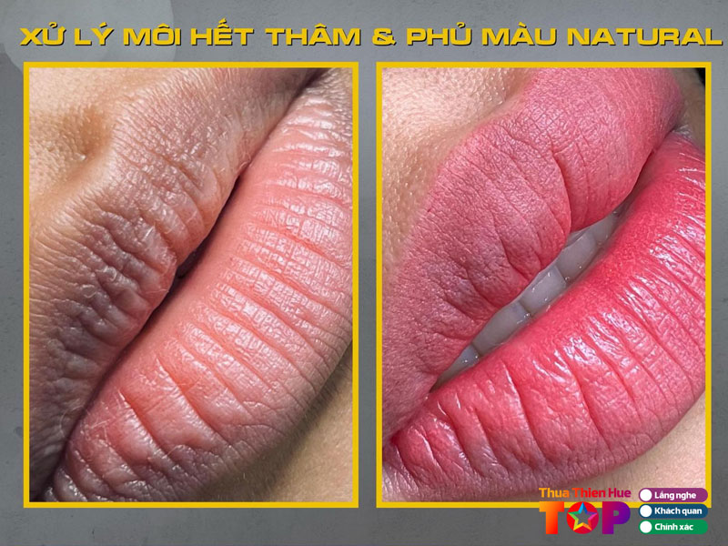 phun-theu-tham-my-quang-huetoplist