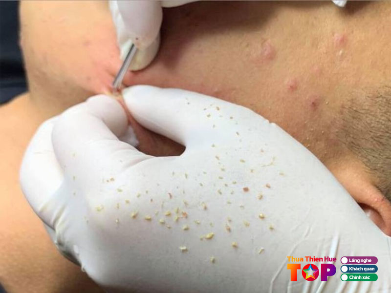 smile-spa-tham-my-cong-nghe-cao-huetoplist