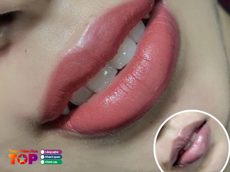 tham-my-vien-nam-phuong-huetoplist