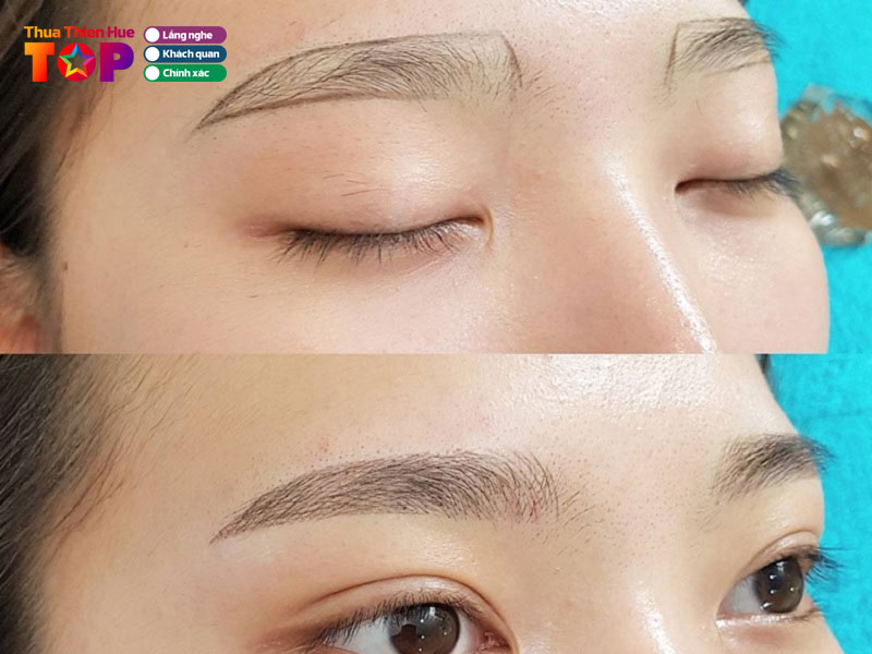 tham-my-vien-seoul-center-huetoplist