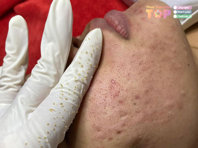 xus-house-cosmetic-spa-huetoplist