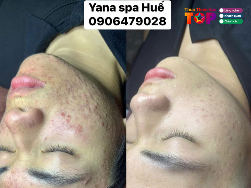 yana-clinic-spa-huetoplist