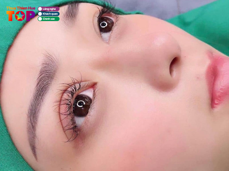 Kinh-nghiem-lua-chon-co-so-de-nhan-mi-huetoplist