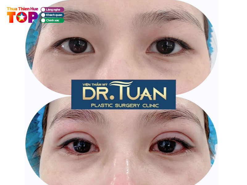 Phong-kham-chuyen-khoa-tham-my-bs-tuan-huetoplist