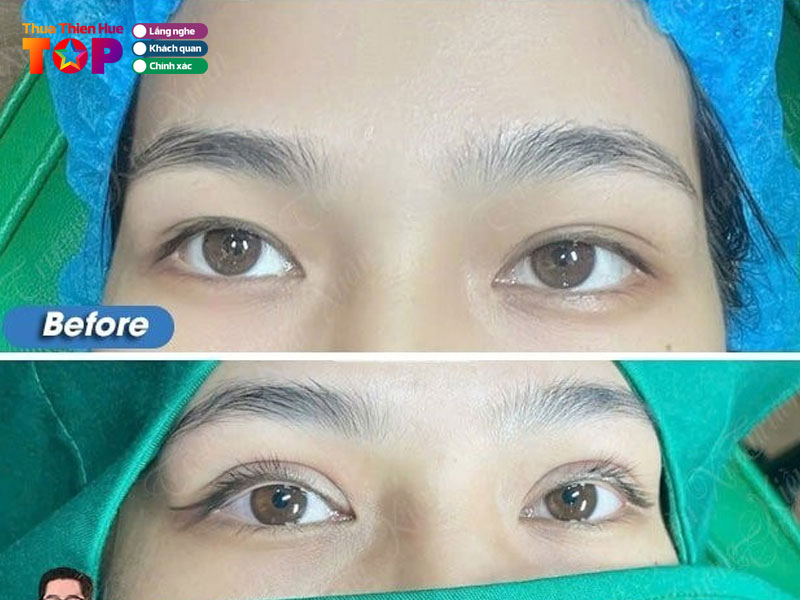 Trung-tam-phau-thuat-tham-my-truong-kieu-xuan-huetoplist