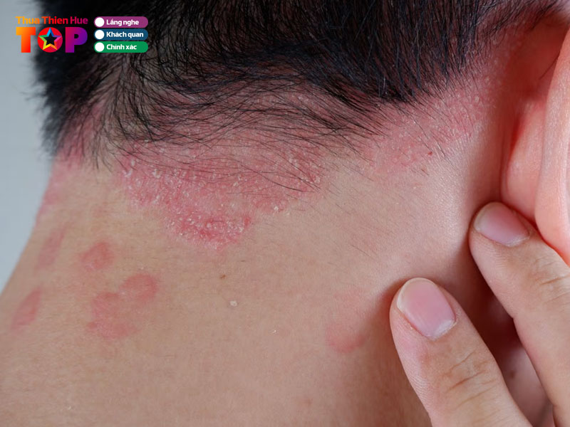 Benh-vien-phong-hue-huetoplist