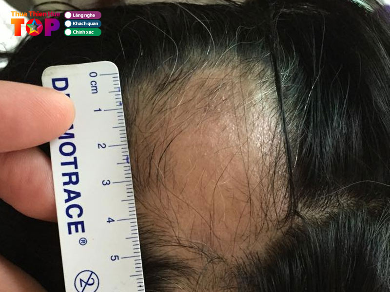 Phong-kham-da-lieu-bs-ckii-duong-huu-thanh-huetoplist