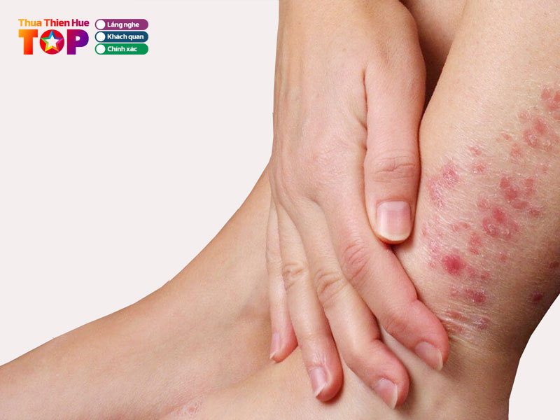 Phong-kham-da-lieu-ts-bs-mai-ba-hoang-anh-huetoplist