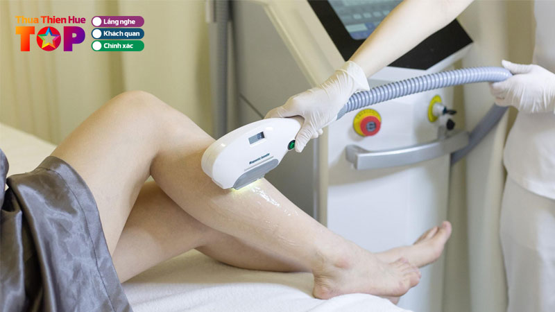 Top-10-spa-triet-long-o-hue-dam-bao-an-toan-hieu-qua-huetoplist