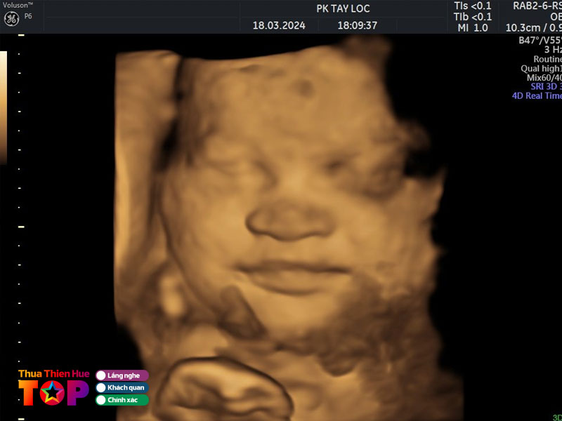 Phong-kham-tay-loc-huetoplist