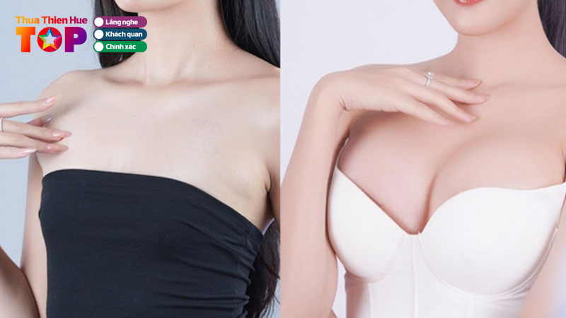 Top-5-dia-chi-nang-nguc-o-hue-dam-bao-uy-tin-an-toan-huetoplist