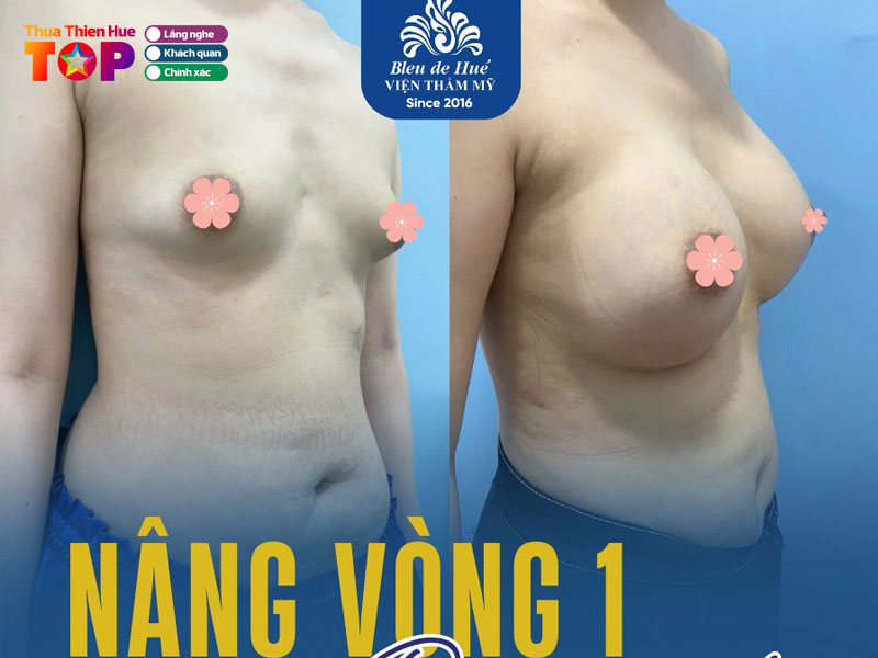 Vien-tham-my-bleu-de-hue-huetoplist