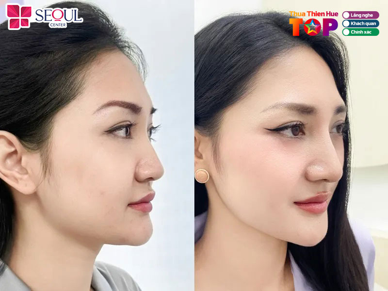 Seoul-center-hue-huetoplist