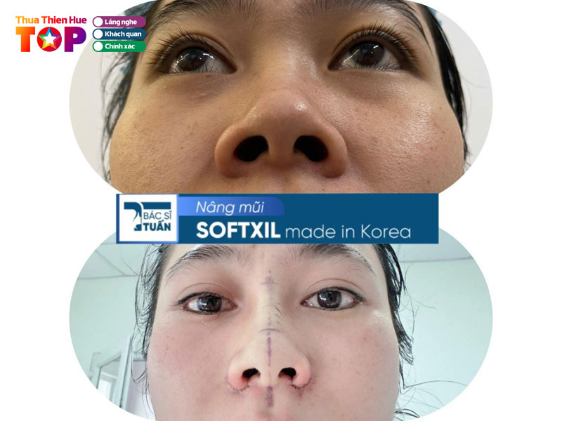 Tham-my-bac-si-tuan-huetoplist