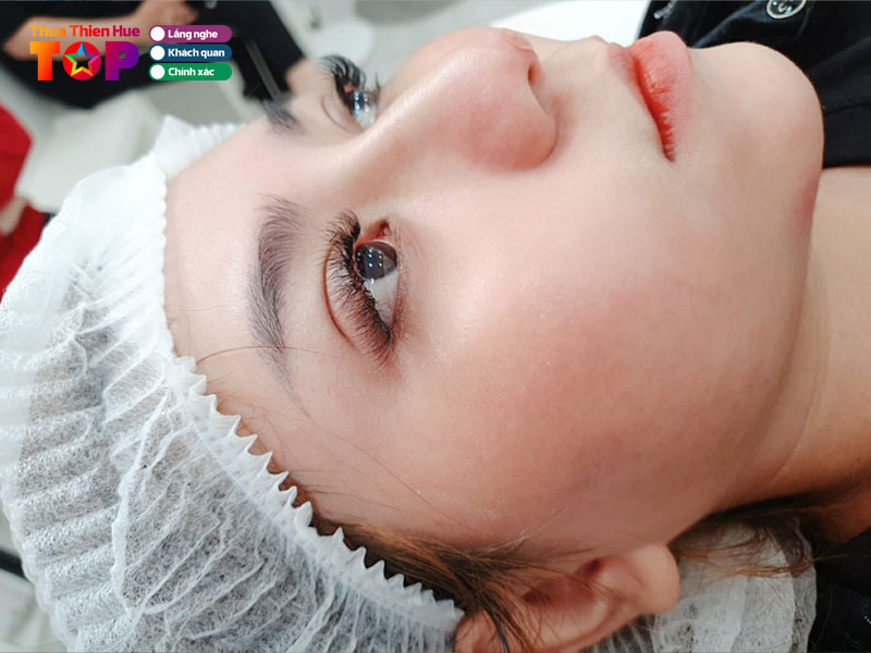 Tham-my-hiep-thanh-huetoplist