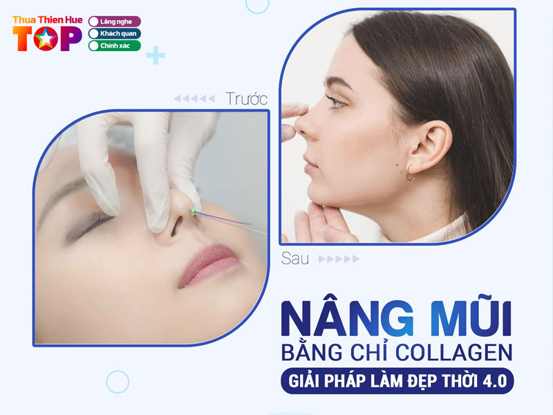 Tham-my-vien-lima-huetoplist