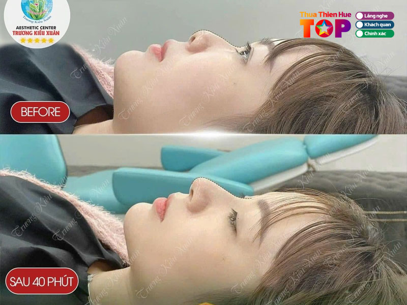 Tham-my-vien-truong-kieu-xuan-huetoplist