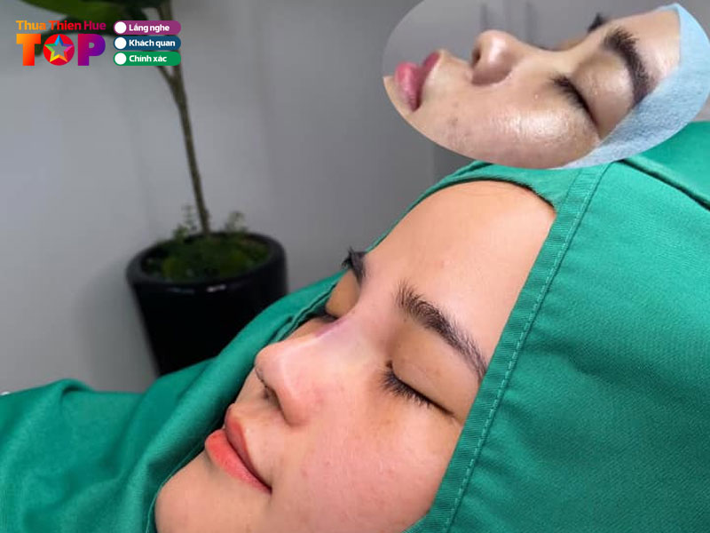 Thao-nguyen-beauty-center-huetoplist