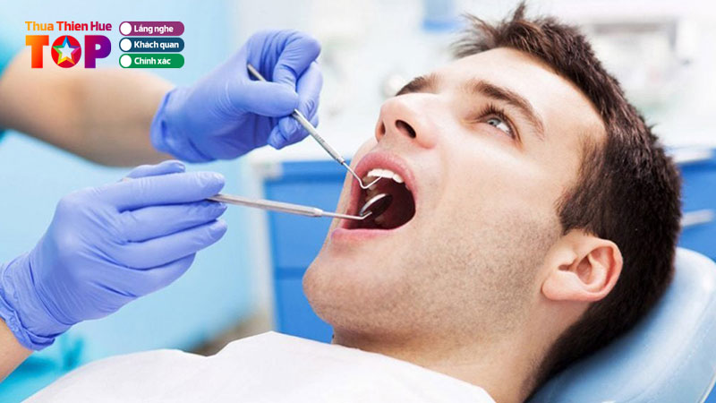 Top-10-dia-chi-nho-rang-khon-hue-khong-dau-gia-cuc-re-huetoplist