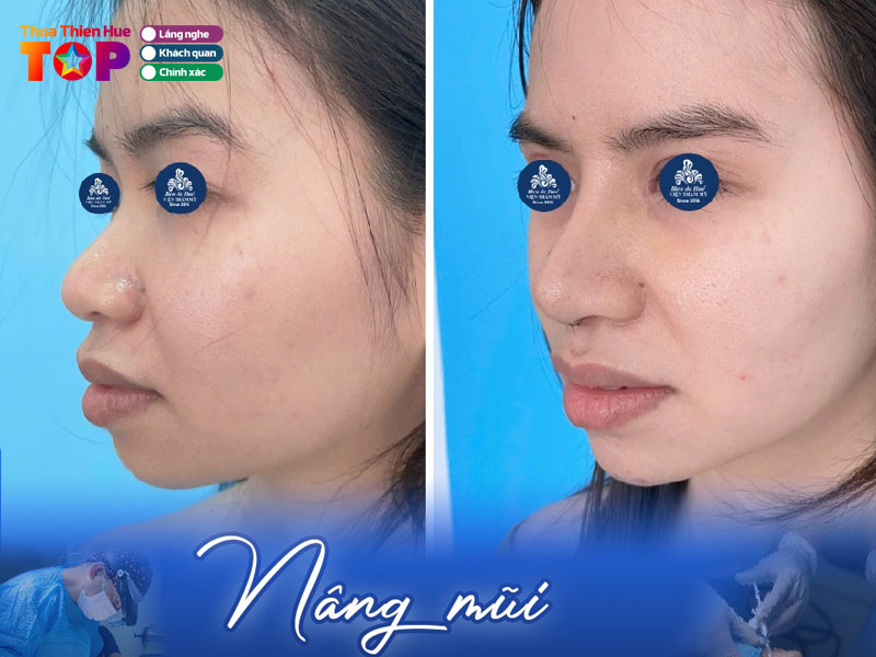 Vien-tham-my-bleu-de-hue-huetoplist