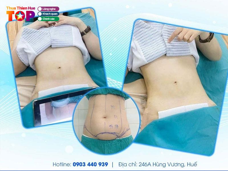 Vien-tham-my-truong-kieu-xuan-huetoplist