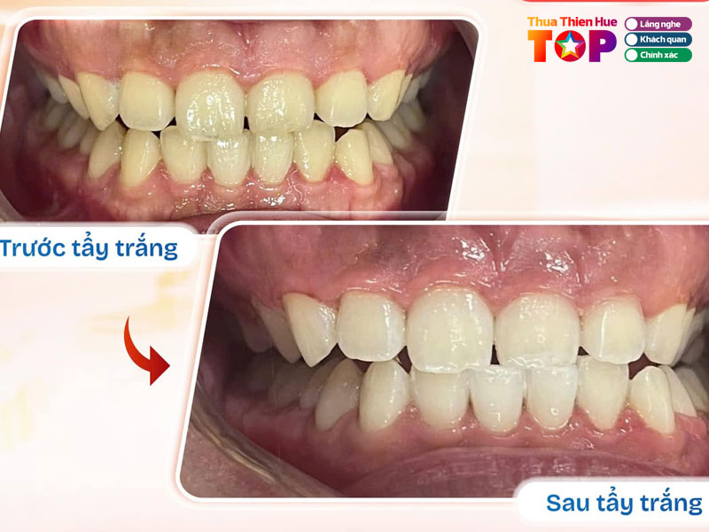 Nha-khoa-phap-viet-huetoplist