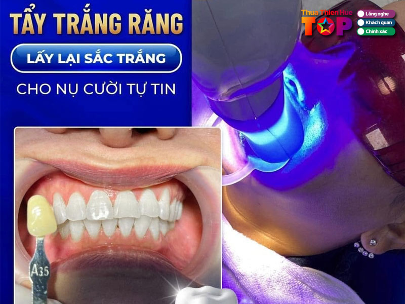 Nha-khoa-viet-uc-huetoplist