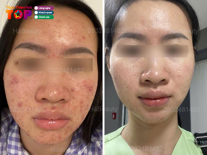 Ha-beauty-spa-huetoplist