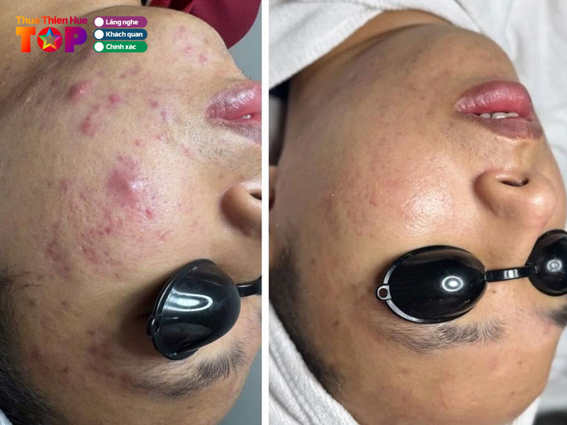 Han-health-beauty-huetoplist