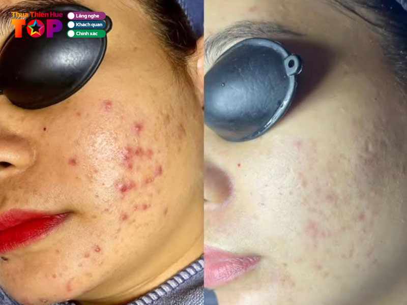 Ngoc-quy-spa-huetoplist