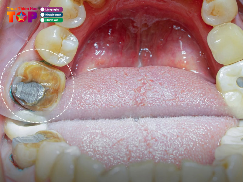 Nha-khoa-livia-dental-huetoplist
