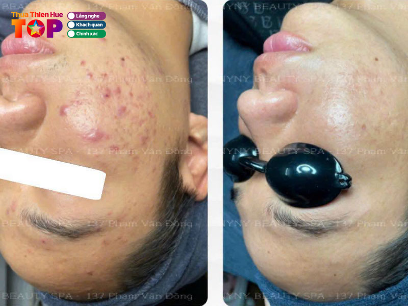 Nyny-beauty-spa-huetoplist