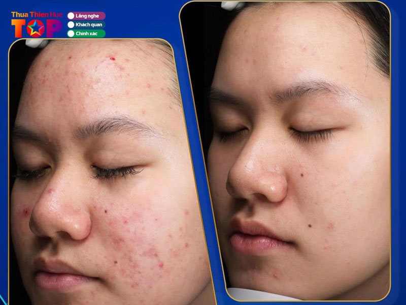 Thien-an-beauty-center-huetoplist