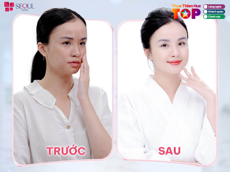 Luu-y-khi-chon-dia-chi-tri-nam-o-hue-huetoplist