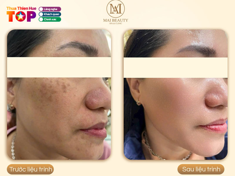 Mai-beauty-spa-clinic-huetoplist