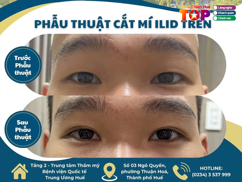 Trung-tam-tham-my-benh-vien-quoc-te-trung-uong-hue-huetoplist