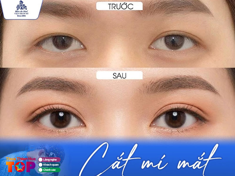 Vien-tham-my-bleu-de-hue-huetoplist